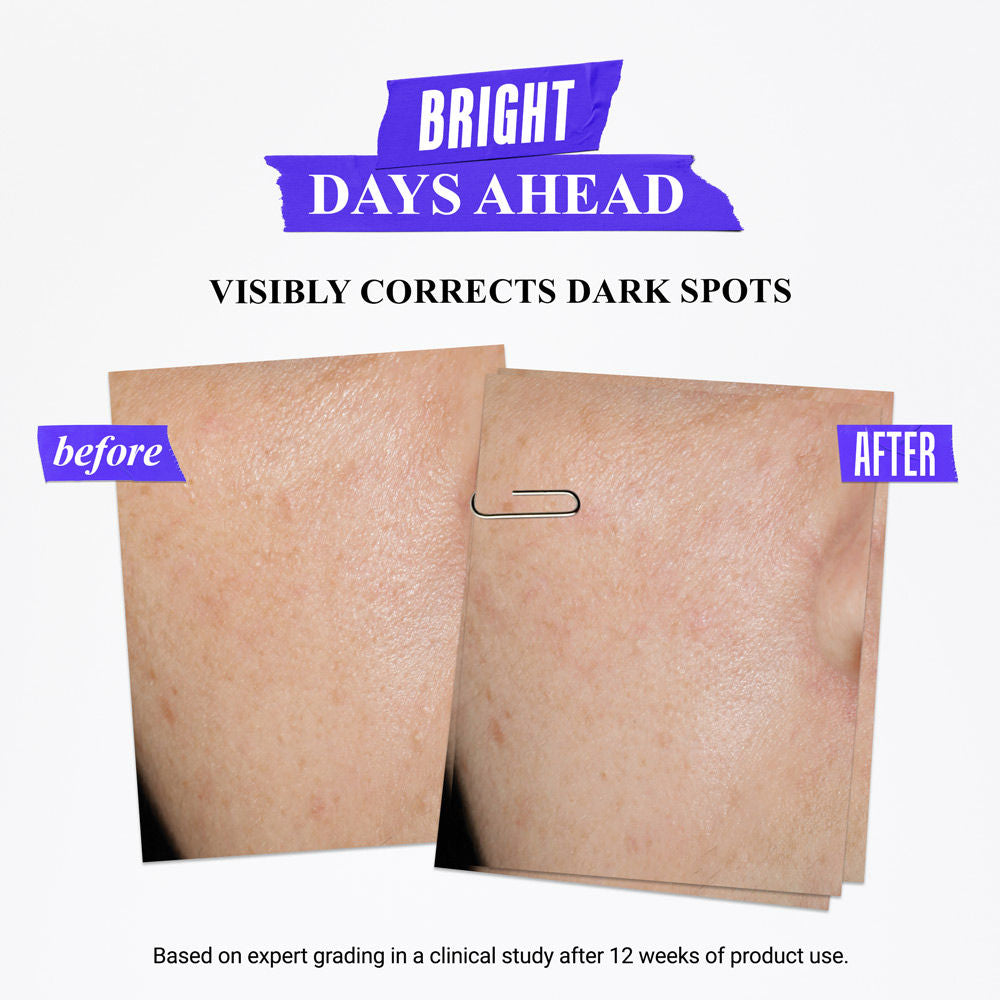 Brightening Ritual