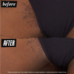 Kiehl's Ingrown Hair And Tone-Correcting Intimate Drops