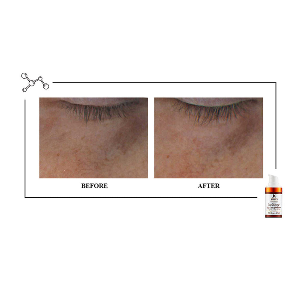 Kiehl's Powerful - Strength Line - Reducing & Dark Circle diminishing Vitamin C Eye Serum