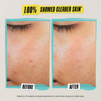 Kiehl's Expertly Clear Blemish-Treating & Preventing Lotion