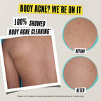 Kiehl's Expertly Clear Blemish-Treating & Preventing Lotion