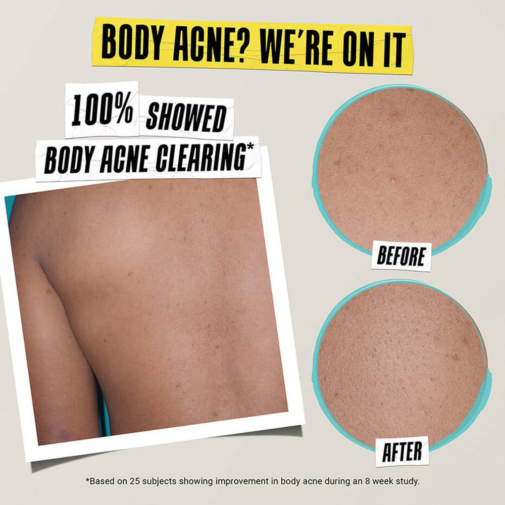 Kiehl's Expertly Clear Blemish-Treating & Preventing Lotion