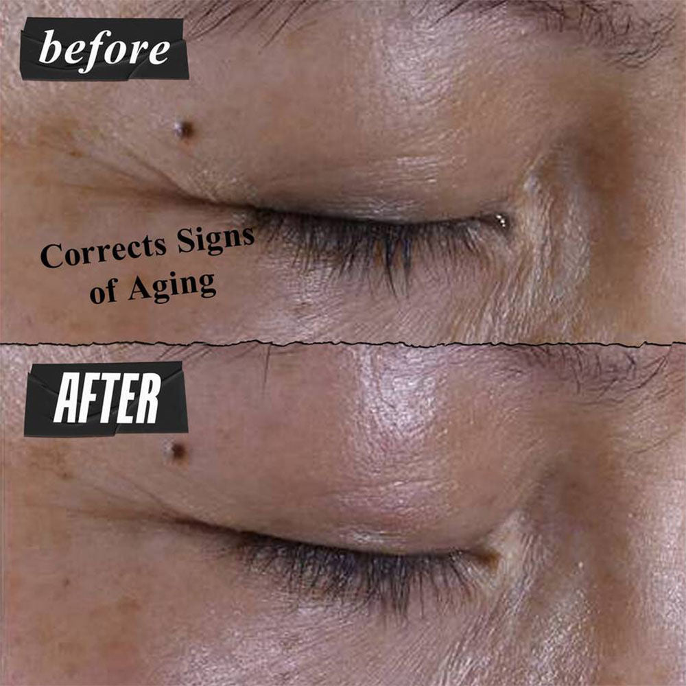 Kiehl's Super Multi-Corrective Eye Zone Treatment with Collagen Peptide & Proxylane