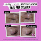 Kiehl's Super Multi-Corrective Eye Zone Treatment with Collagen Peptide & Proxylane